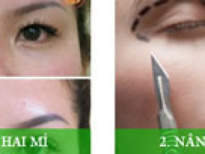 PHẨU THUẬT  THẨM MỸ QUỐC TẾ