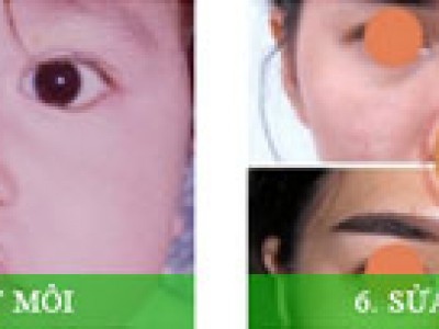 PHẨU THUẬT  THẨM MỸ QUỐC TẾ