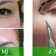 PHẨU THUẬT  THẨM MỸ QUỐC TẾ