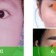 PHẨU THUẬT  THẨM MỸ QUỐC TẾ